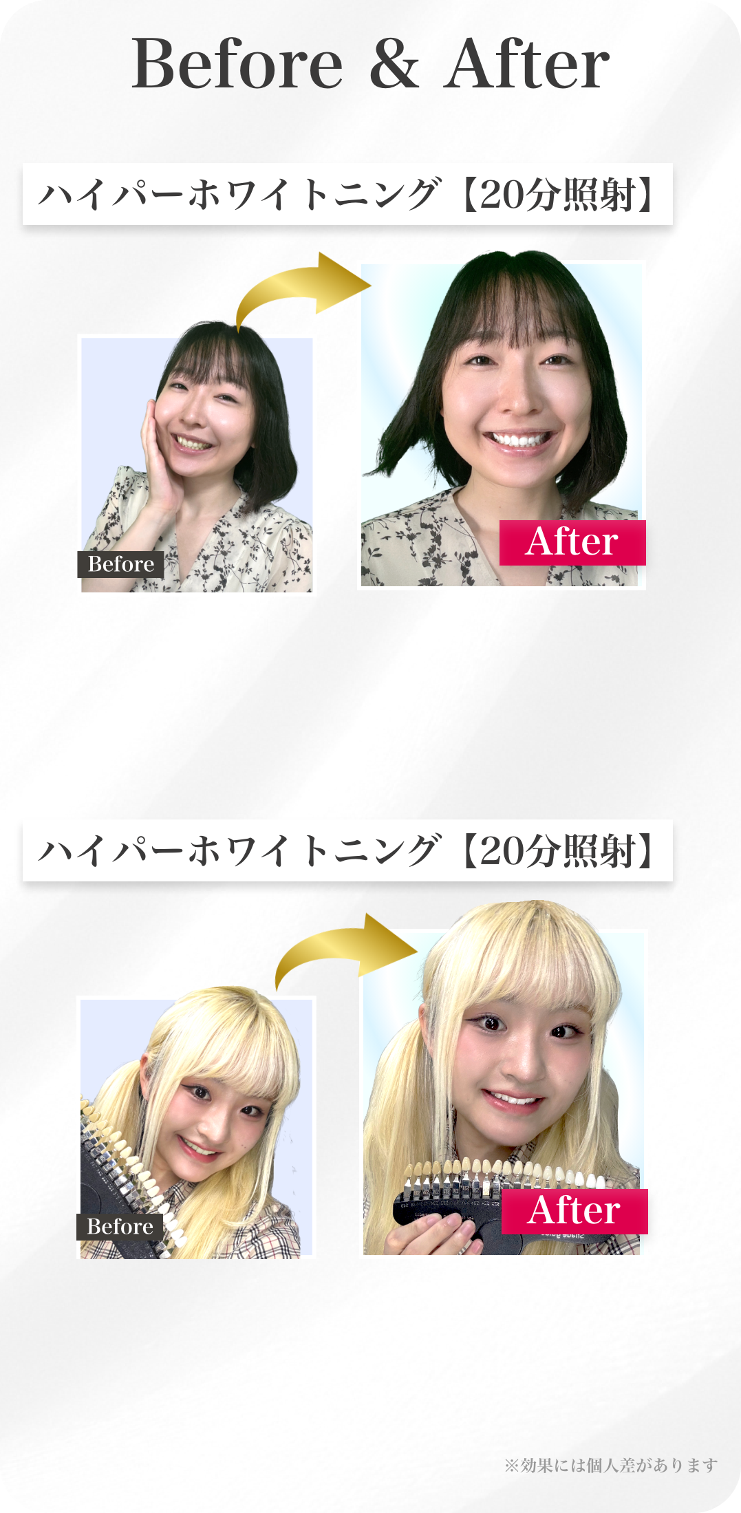 ホワイトニングのビフォーアフター